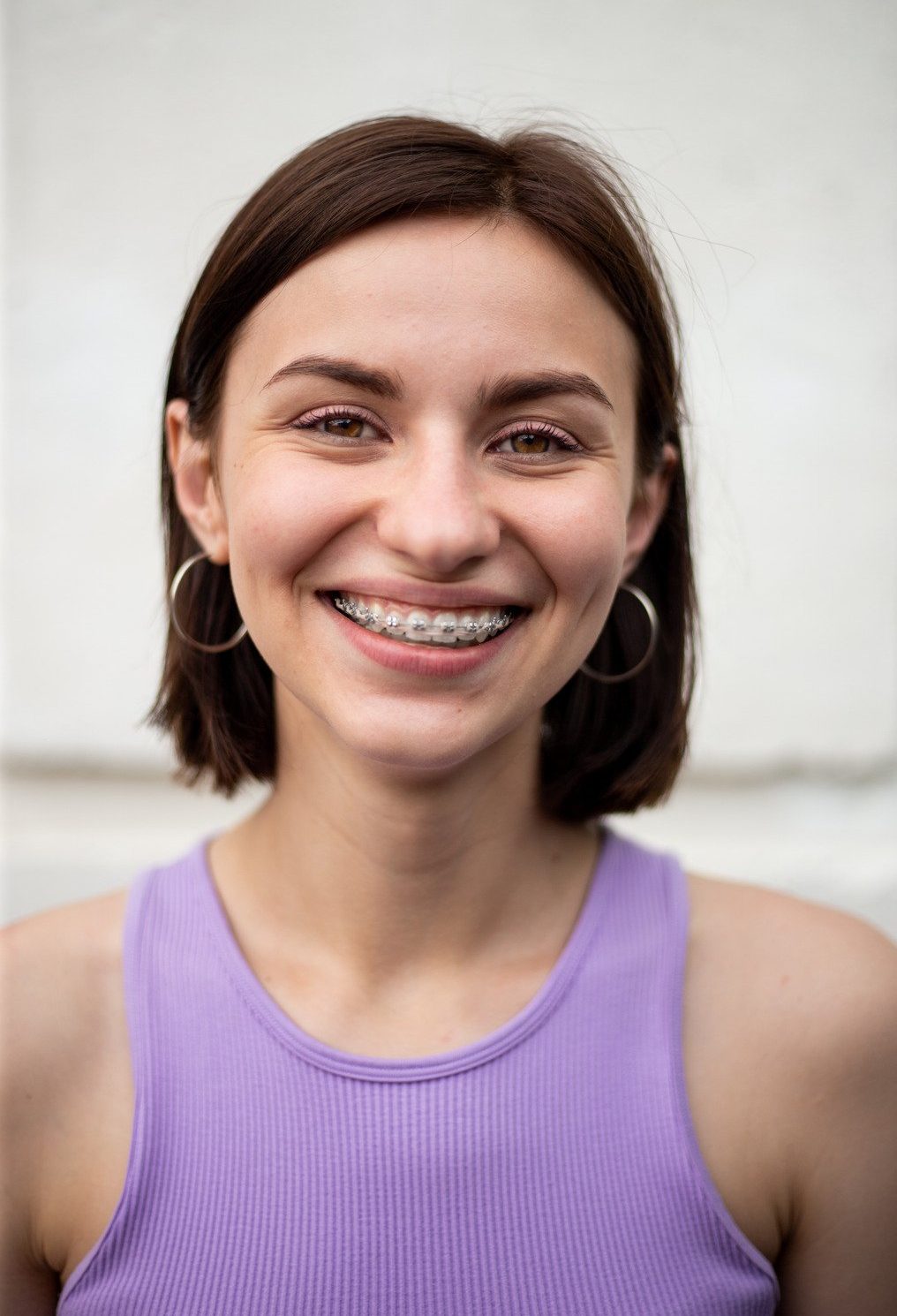 Traditional Braces